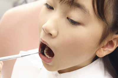 お子様のむし歯予防